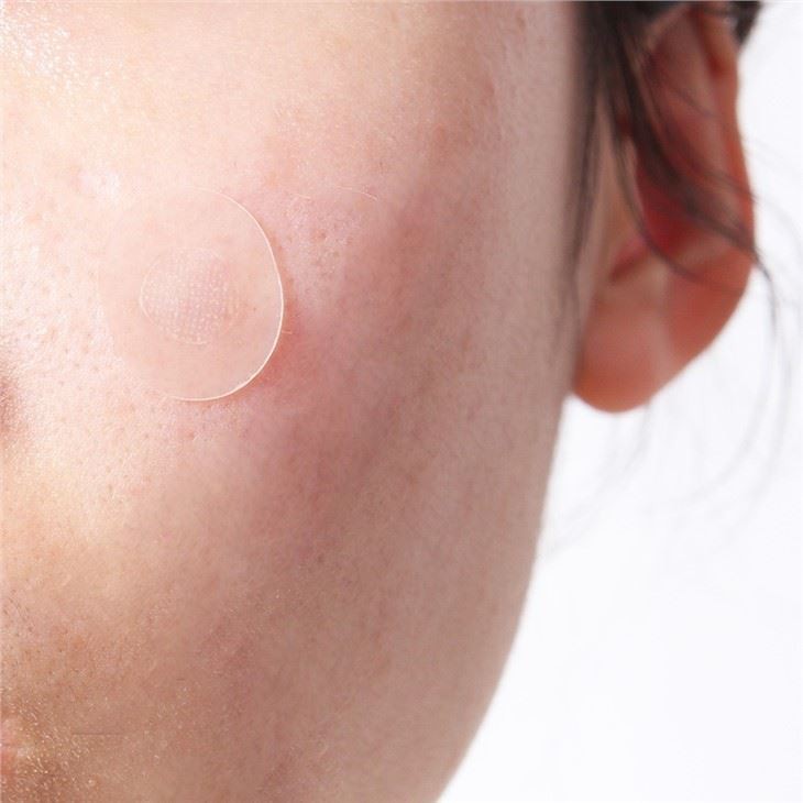 cute acne patch